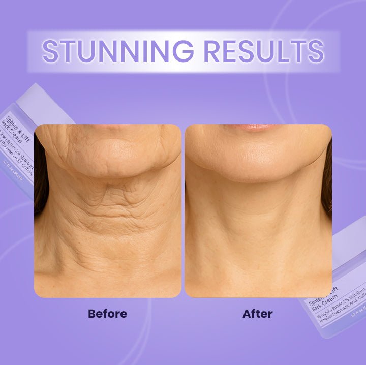 Tighten & Lift Neck Cream | Anti-Aging Neck Firming Cream